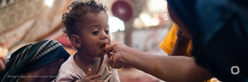 Yemen: One in two children severely malnourished after 10 years of war Yemen: One in two children severely malnourished after 10 years of war