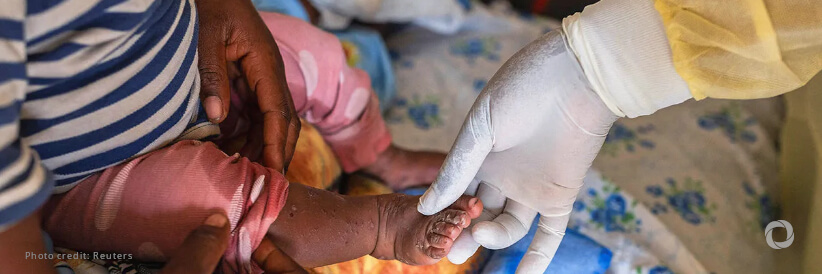 Gavi delivers largest shipment yet to DRC in support of international mpox response Gavi delivers largest shipment yet to DRC in support of international mpox response