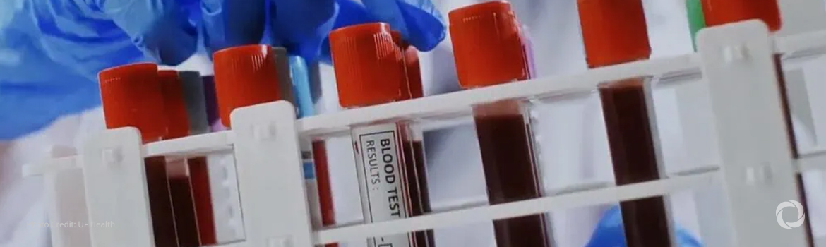 South Sudan collects 86 blood units in donation drive