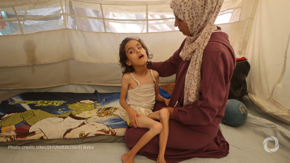Gaza child malnutrition hits record 19% in August