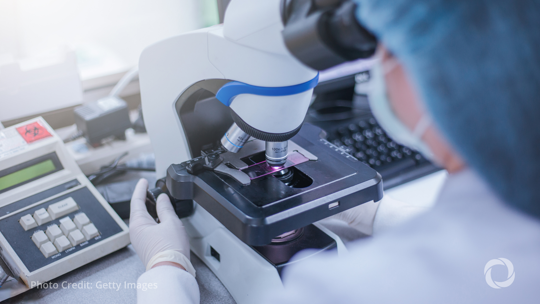 French medtech EDAP gets €36 million EIB loan for cancer treatment French medtech EDAP gets €36 million EIB loan for cancer treatment