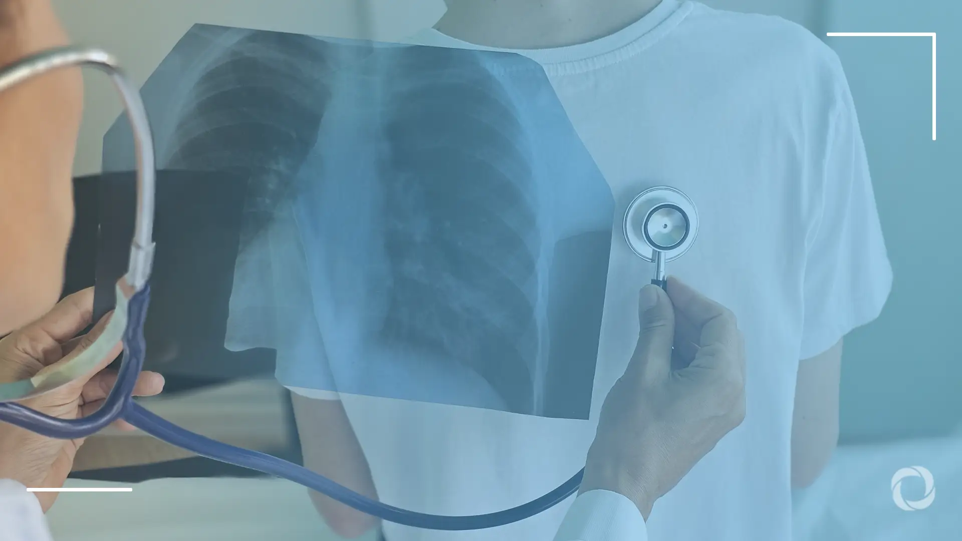 Seventy lives a day: The unfinished fight against tuberculosis in the Philippines
