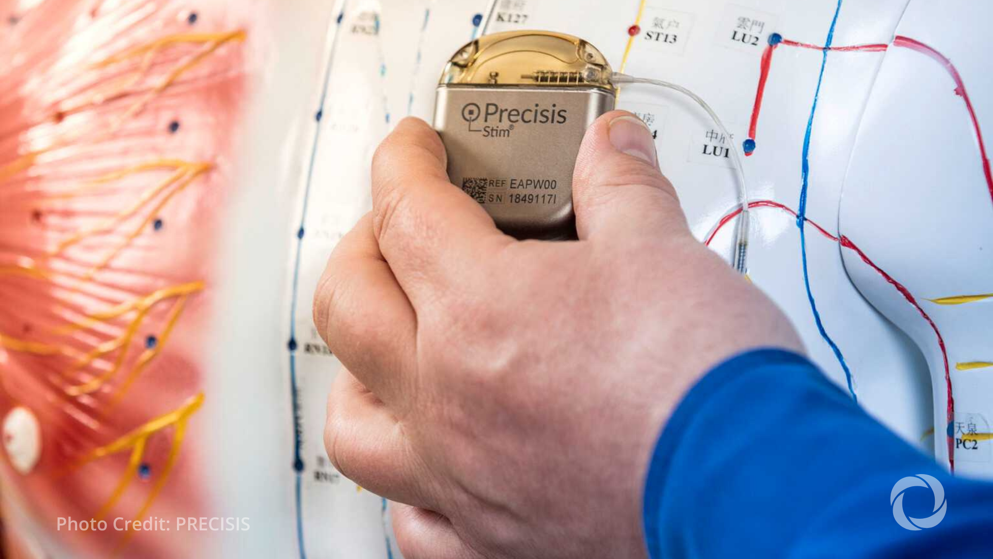 EIB lends €20M to German epilepsy treatment company EIB lends €20M to German epilepsy treatment company