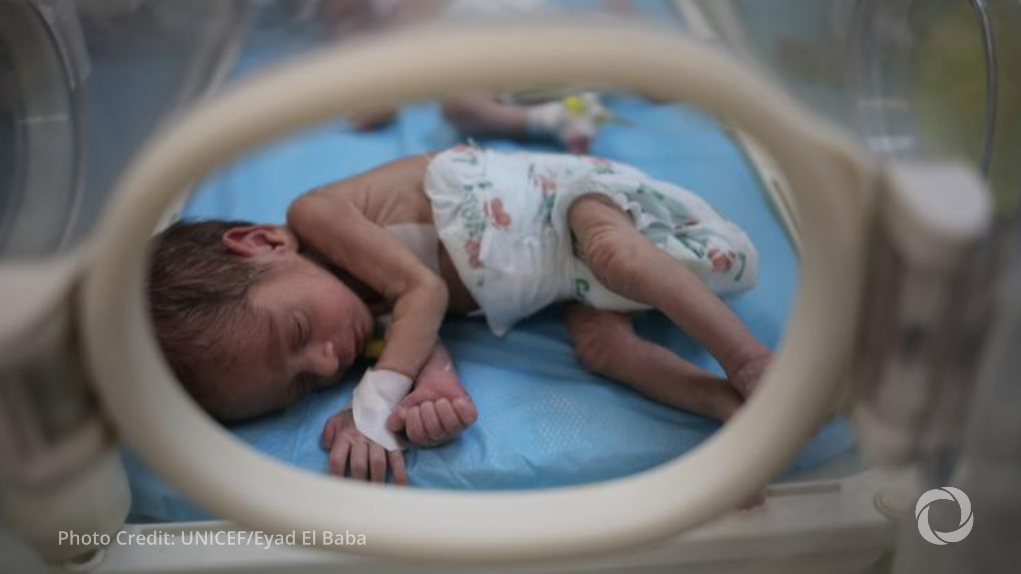 UNICEF warns of devastating toll of malnutrition on Gaza's mothers and newborns