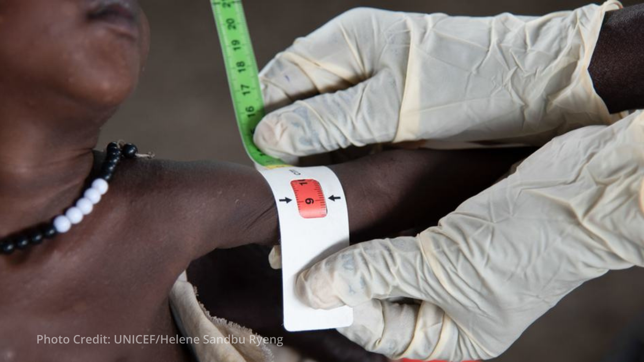 UN chief warns of 'perfect storm' as South Sudan fighting displaces nearly 280,000 UN chief warns of 'perfect storm' as South Sudan fighting displaces nearly 280,000