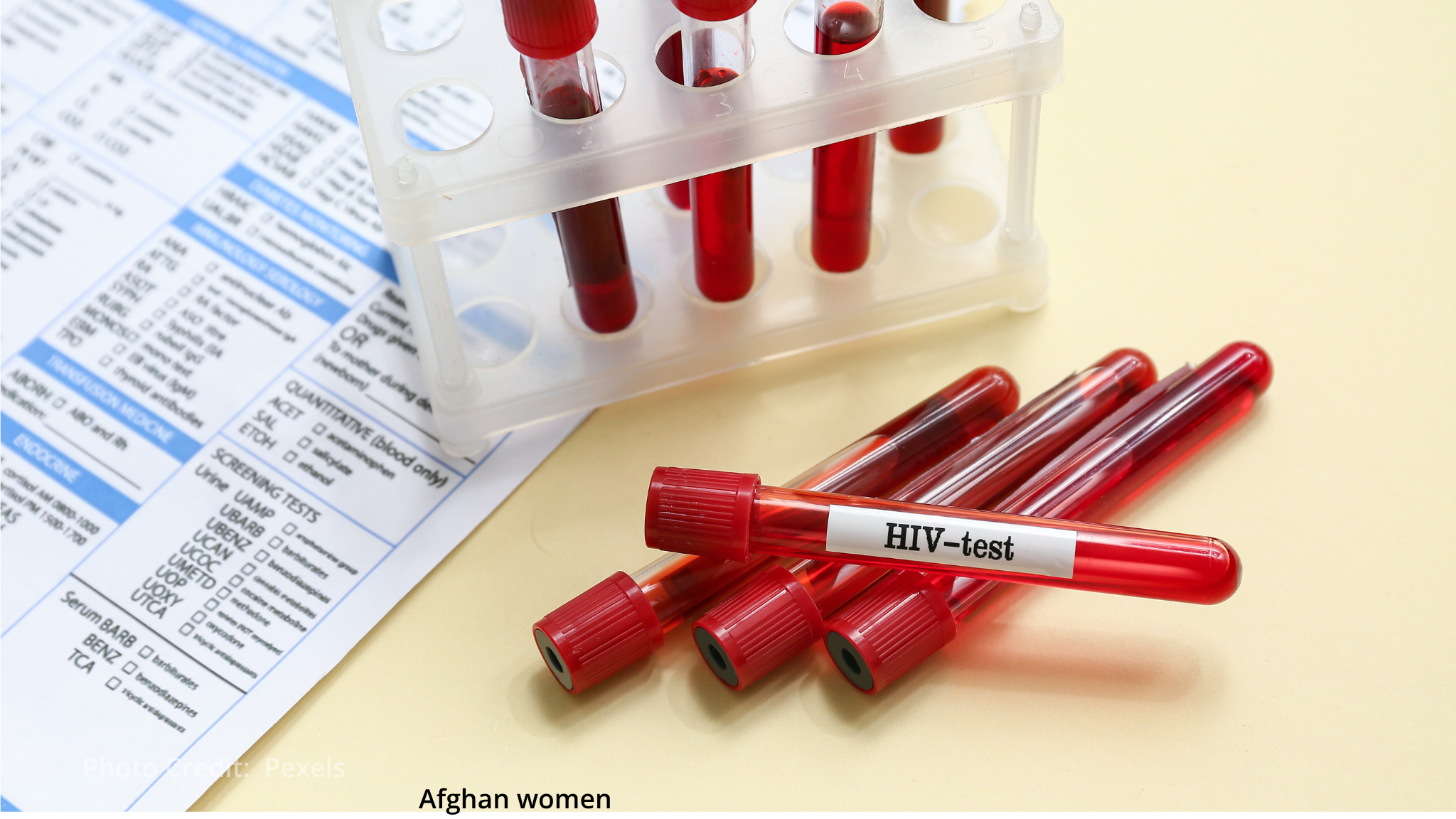 HIV prevention and treatment services faltering, warns UNAIDS
