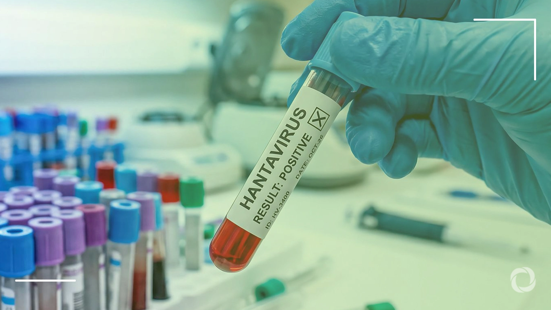 How the collapse of nature turned hantavirus into a global threat