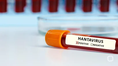 Could the hantavirus outbreak