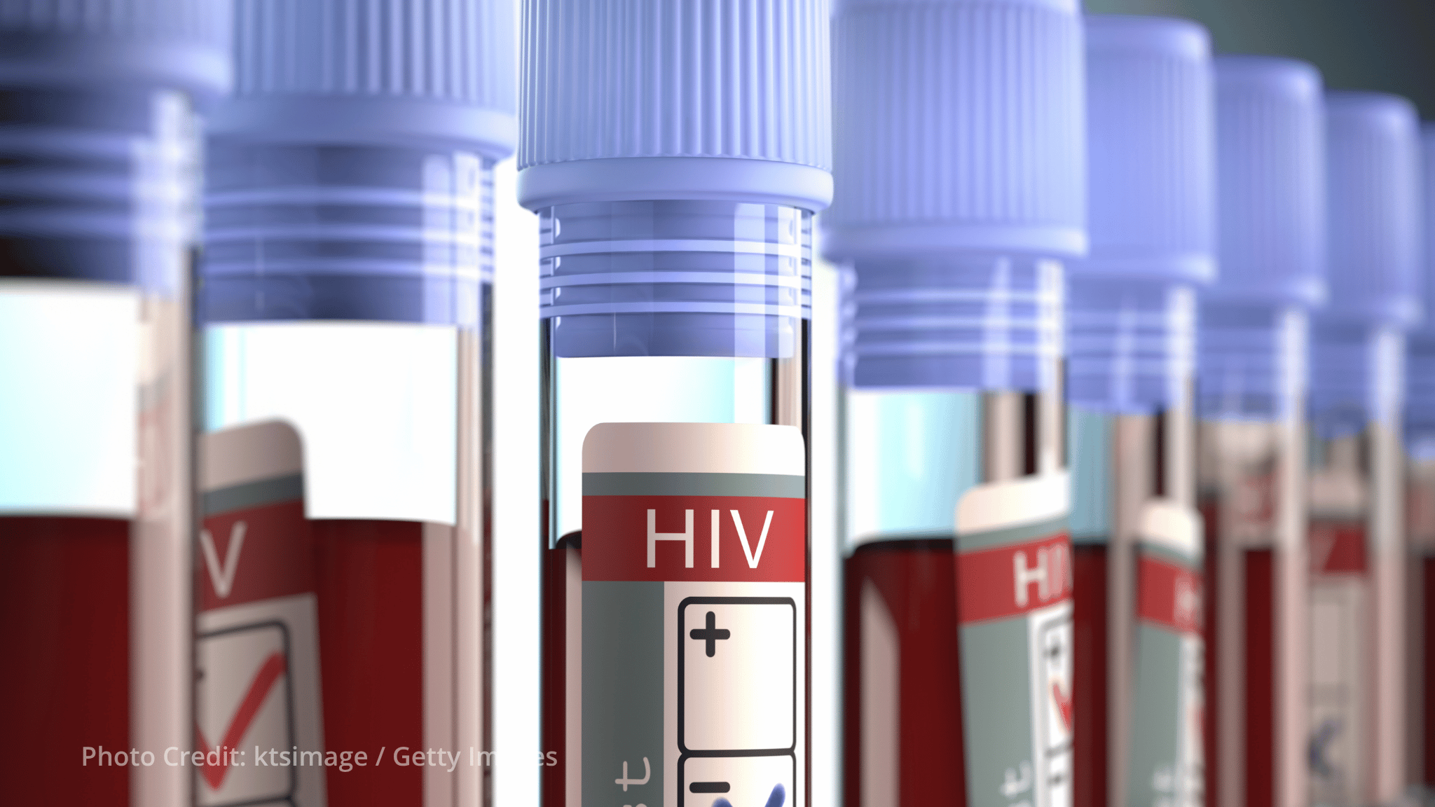 PAHO and AIDS Healthcare Foundation join forces to expand early HIV diagnosis PAHO and AIDS Healthcare Foundation join forces to expand early HIV diagnosis