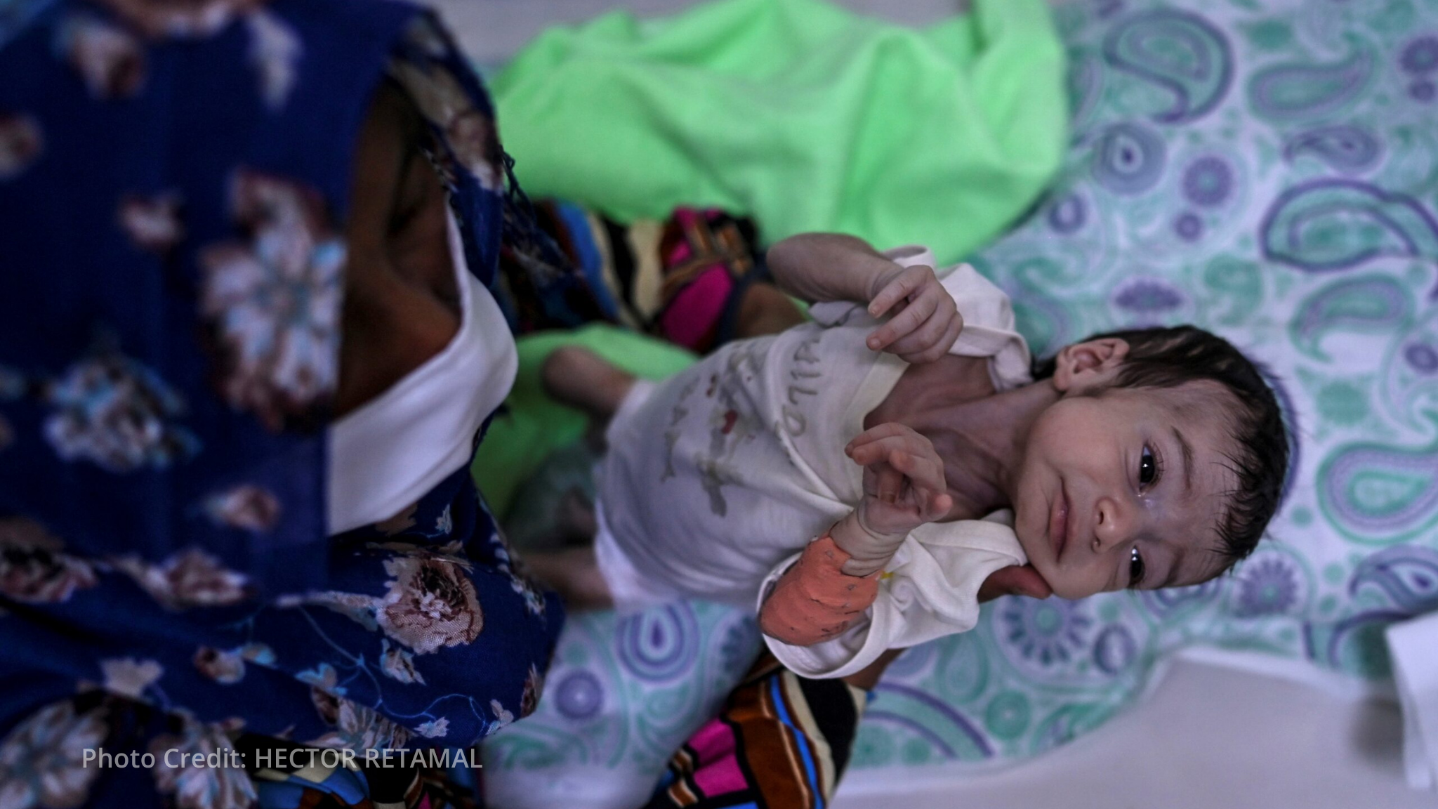 One million children in Afghanistan face deadly malnutrition