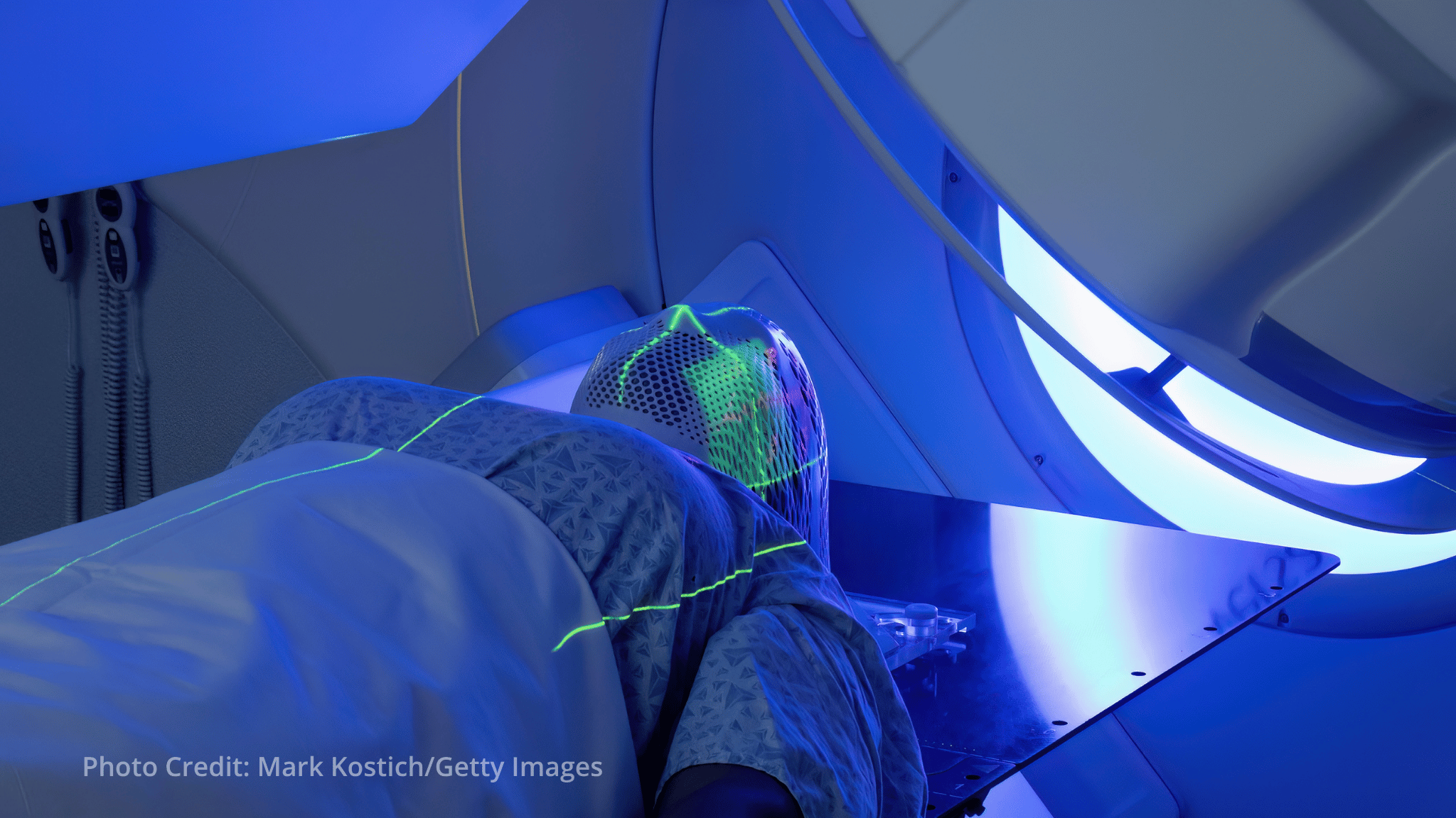 IAEA helps countries mobilize investment to expand radiotherapy services