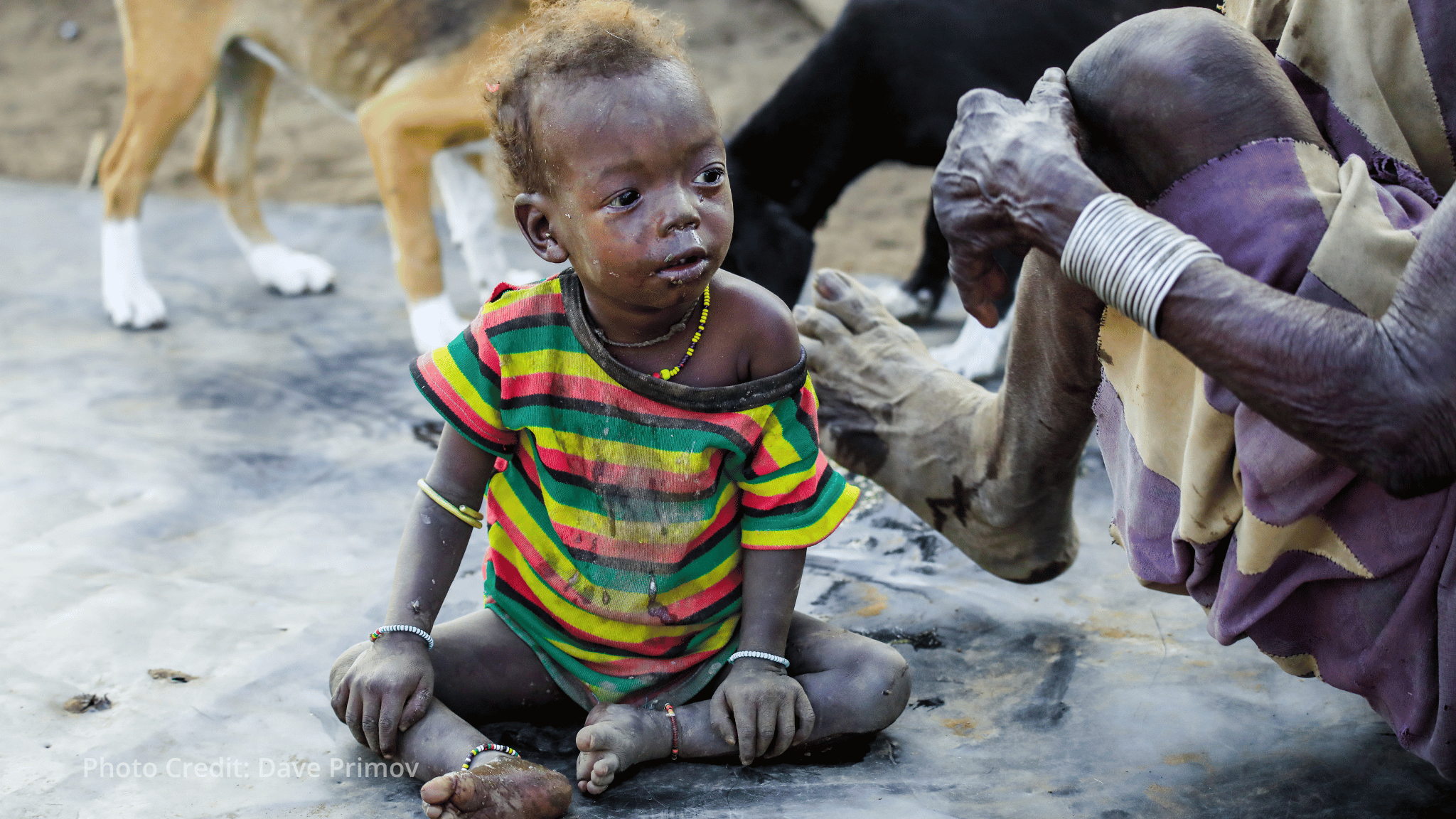 Somalia health centers close as hunger and drought deepen Somalia health centers close as hunger and drought deepen